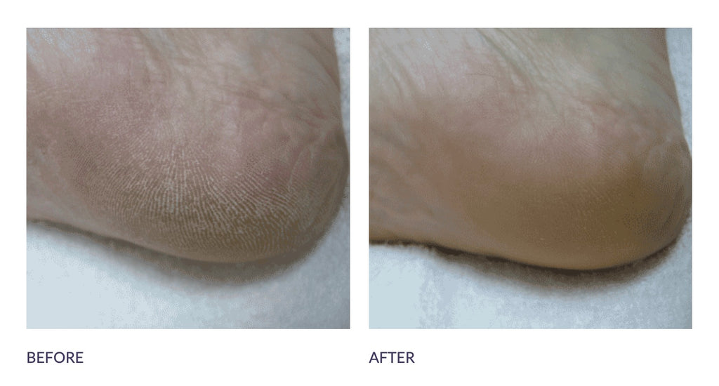 Footlogix Soins Quotidiens 2 - Boutique du Cordonnier 